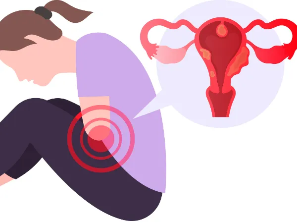 性感染症のリスク